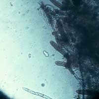 Aquarium M&uuml;nster DESSAMOR - Gegen Pilzinfektionen